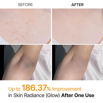 Dr.Melaxin Peel Shot Kojic Acid Spray